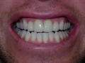 Los Angeles Cosmetic Dentist